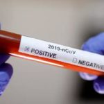 Coronavirus1583158873